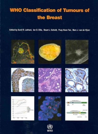 S.j., P., Tan, S.R. WHO Classification of Tumours of the Breast, Fourth Edition 