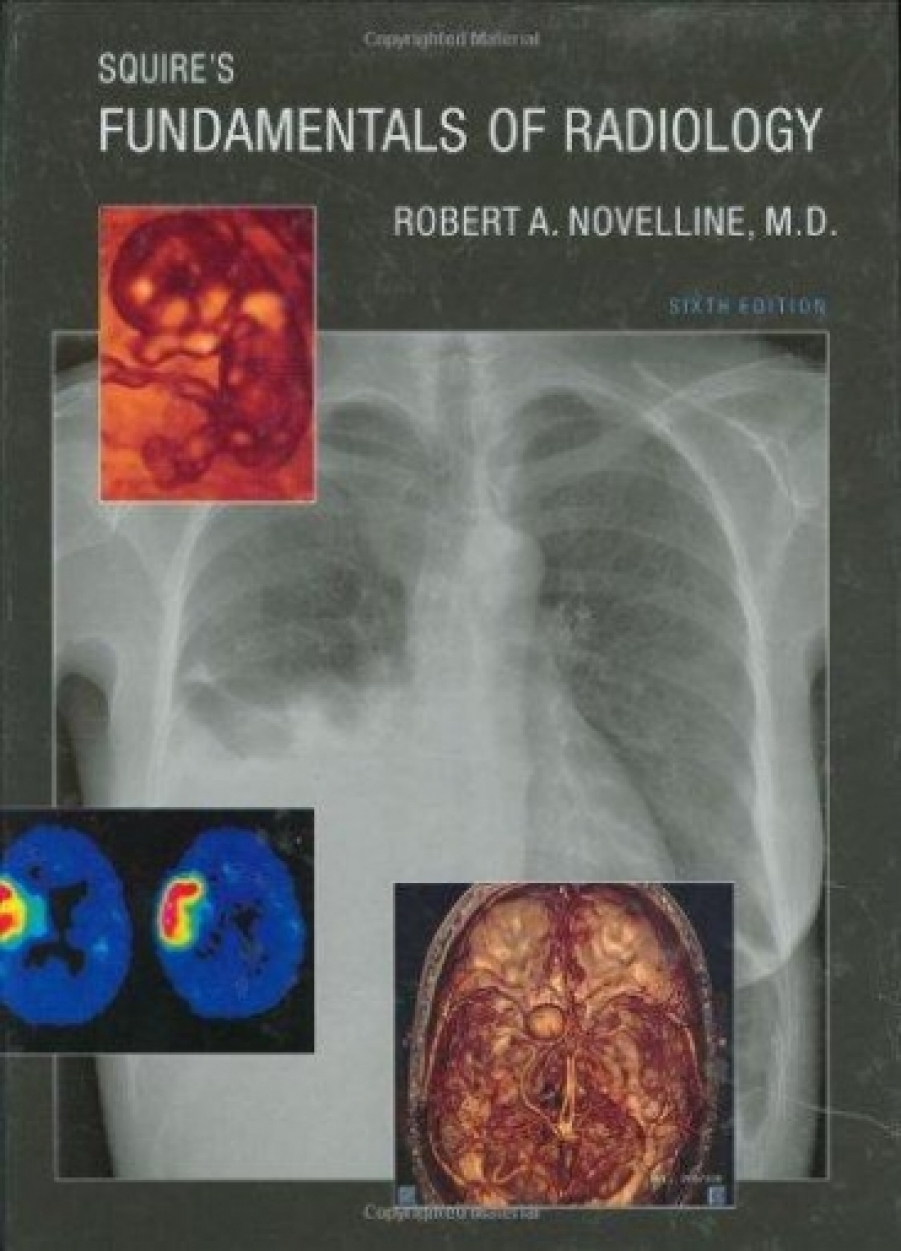 Robert A., Novelline Squire's fundamentals of radiology, 6 ed. 