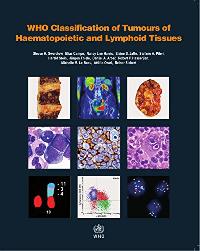 Swerdlow S., Campo E., Harris N. L. WHO Classification of Tumours of Haematopoietic and Lymphoid Tissues. Revized 4 ed. 