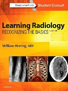 William Herring Learning Radiology: Recognizing the Basics, 3rd Edition 