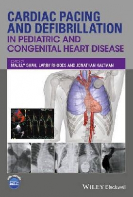 Shah Cardiac Pacing and Defibrillation in Pediatric and  Congenital Heart Disease 