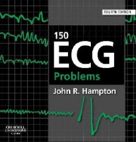 John R. Hampton 150 ECG Problems, 