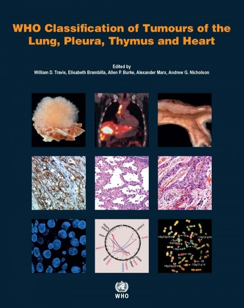 Travis W.D. WHO Classification of Tumours of the Lung, Pleura, Thymus and Heart. 4 ed. 