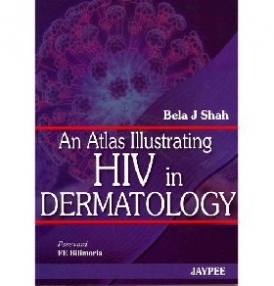 Bela J Shah An Atlas Illustrating HIV in Dermatology 