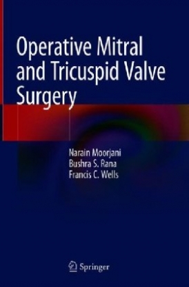 Moorjani Operative Mitral and Tricuspid Valve Surgery 