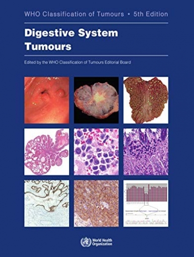 Who Classification of Tumours Editorial Board 5 ed Who Classification of  Digestive System Tumours. 5 ed 