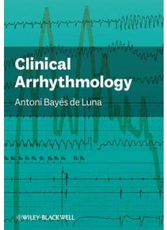 Antonio Bayes de Luna MD, FESC, FACC Clinical Arrhythmology 