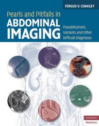 Fergus V.C. Pearls and Pitfalls in Abdominal Imaging. Pseudotumors, Variants and Other Difficult Diagnoses 