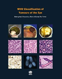 Grossniklaus H. E., Eberhart C., Kivela T. WHO Classification of Tumours of the Eye 