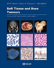 Who Classification of Tumours Editorial WHO Classification of Tumours: Soft Tissue and Bone Tumour. 5 Ed. 