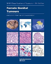 WHO Classification -  Female Genital Tumours. 5 ed 