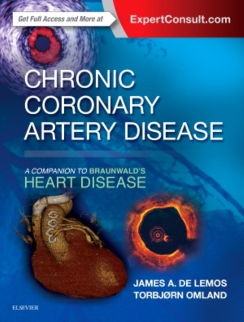 Delemos James Chronic Coronary Artery Disease 