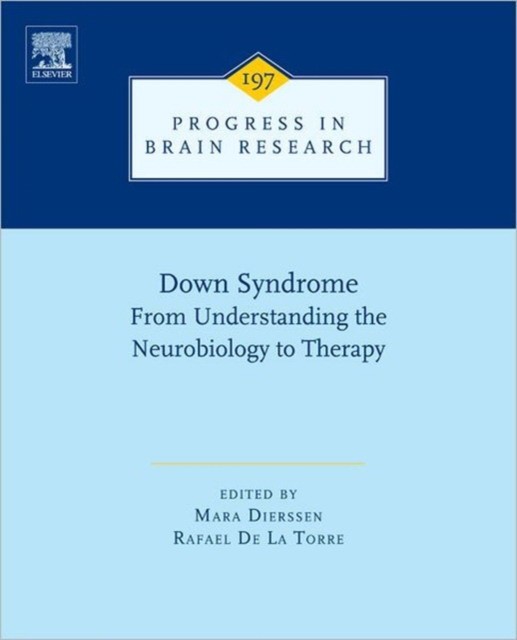 Mara Dierssen Down Syndrome: From Understanding the Neurobiology to Therapy 