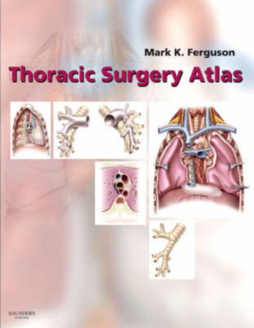 Mark Ferguson Thoracic Surgery Atlas 