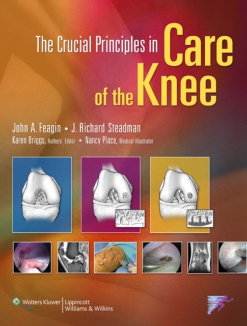 Feagin The Crucial Principles in Care of the Knee 