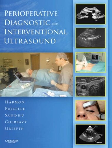Dominic Harmon Perioperative Diagnostic and Interventional Ultrasound with DVD 