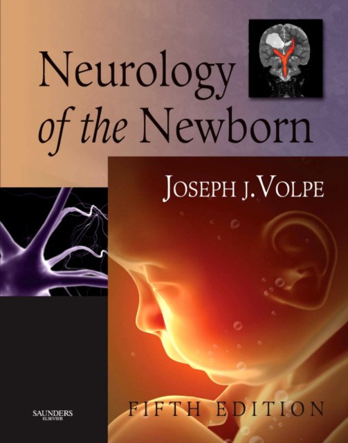 Joseph Volpe Neurology of the Newborn 