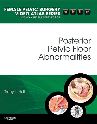 Tracy L. Hull Posterior Pelvic Floor Abnormalities 