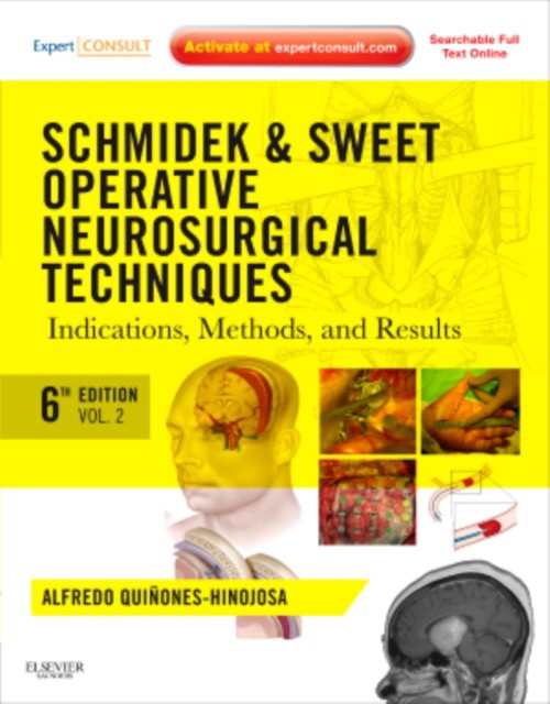 A. Quinones-Hinojosa Schmidek and Sweet: Operative Neurosurgical Techniques, 