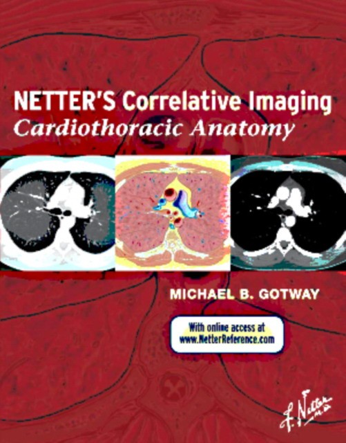 Michael Gotway Netters Correlative Imaging: Cardiothoracic Anatomy, 
