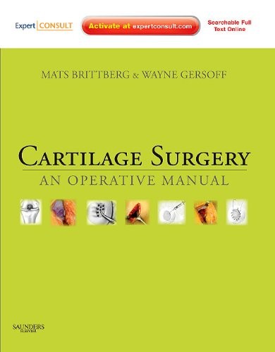 Mats Brittberg Cartilage Surgery 