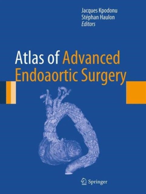 Kpodonu Atlas of Advanced Endoaortic Surgery 