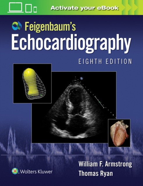 Thomas, Armstrong, William F. Ryan Feigenbaum's echocardiography. 8 ed 