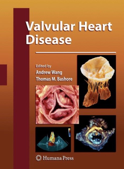 Andrew Wang, Thomas  Bashore Valvular Heart Disease 