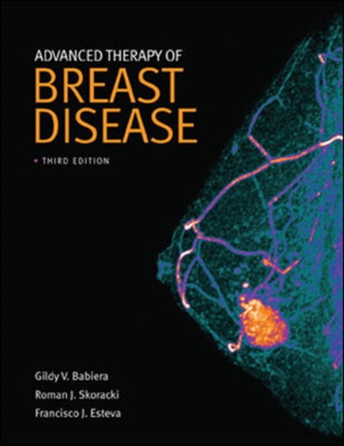 Babiera Advanced therapy of breast disease 