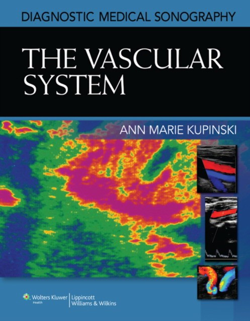 Ann Marie, Kupinski Diagnostic Medical Sonography :Vascular Imaging 
