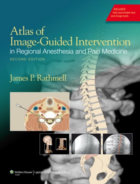 Rathmell Atlas of Image-Guided Intervention in Pain Medicine, 2e 