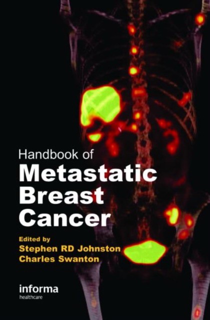 Johnston Handbook Of Metastatic Breast Cancer 
