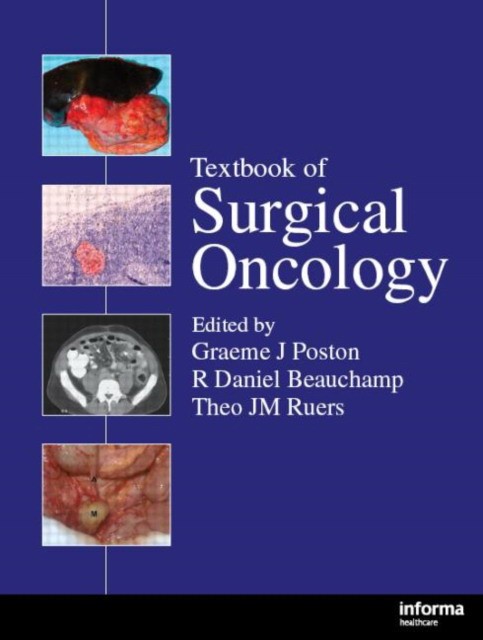 Poston Textbook Surgical Oncology 
