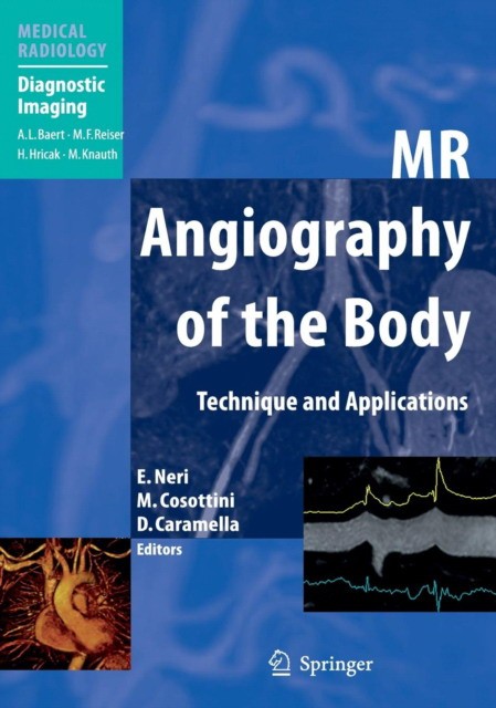 Emanuele Neri, Mirco Cosottini, Davide Caramella MR Angiography of the Body 