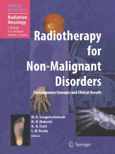 Michael Heinrich Seegenschmiedt Radiotherapy for Non-Malignant Disorders 