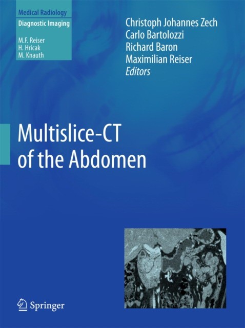 Zech Multislice-CT of the Abdomen 