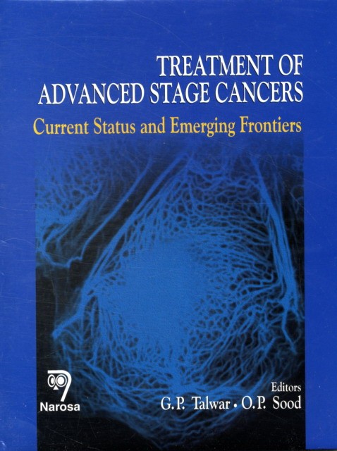 G.P. Talwar Treatment of advanced stage cancers 