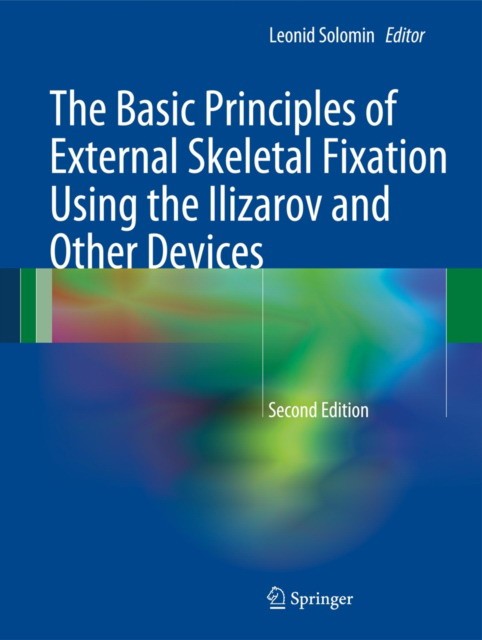 Solomin The Basic Principles of External Skeletal Fixation Using the Ilizarov and Other Devices 
