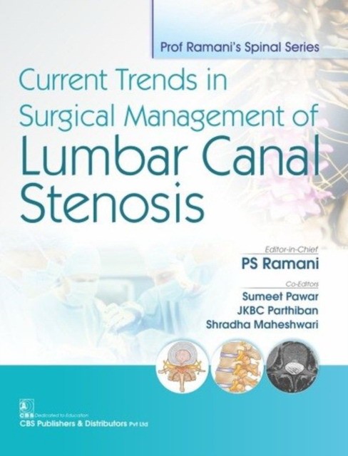 Ramani P S Current Trends In Surgical Management Of Lumbar Canal Stenosis 
