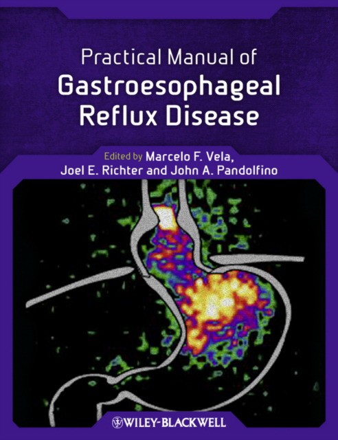 Vela Practical Manual of Gastroesophageal Reflux Disease 