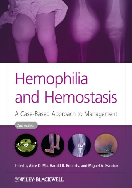Ma Hemophilia and Hemostasis: A Case-Based Approach to Management, 2nd Edition 