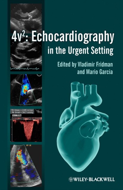 Fridman Practical Manual of Echocardiography in the Urgent Setting 