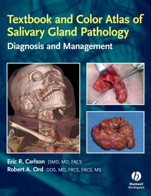 Carlson Textbook and Color Atlas of Salivary Gland Pathology 