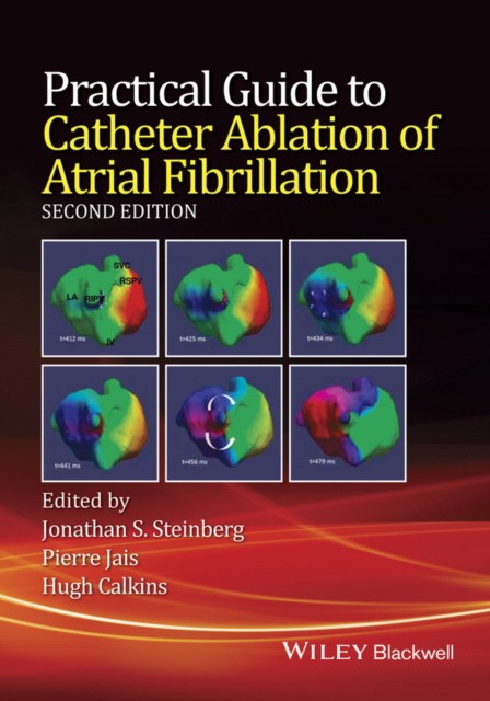 Jonathan Steinberg, Pierre JaisHugh Calkins Practical Guide to Catheter Ablation of Atrial Fibrillation 