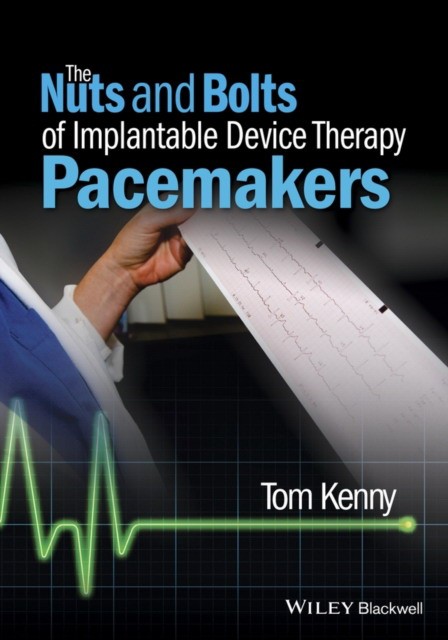 Tom Kenny The Nuts and Bolts of Implantable Device Therapy: Pacemakers 