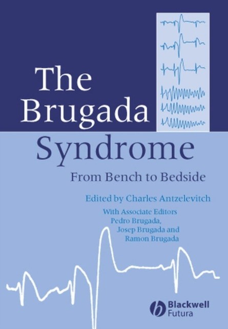 Antzelevitch The Brugada Syndrome.2005 