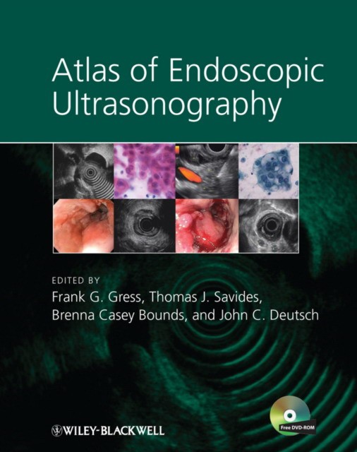 Frank Gress (Editor), Thomas Savides (Editor), Bre Atlas of endoscopic ultrasonography 