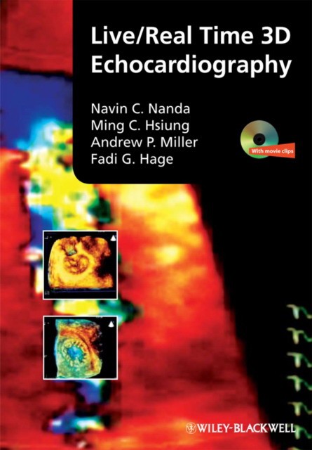 Nanda, Navin C. Hsiung, Ming Chon Miller, Andrew P Live/real time 3d echocardiography 