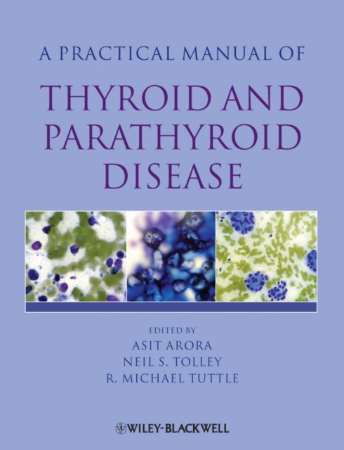 Asit AroraAsit Arora Practical Manual of Thyroid and Parathyroid Disease 