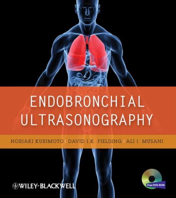 Kurimoto Endobronchial Ultrasonography 